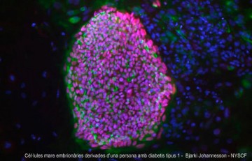 Cèl·lules mare embrionàries derivades d'una persona amb diabetis tipus 1 - Bjarki Johannesson - NYSCF