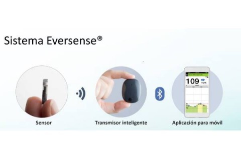 El nuevo sensor Eversense®: un estudio evalúa su precisión