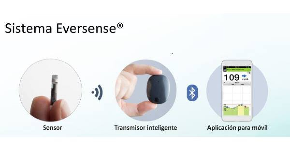 sensor eversense