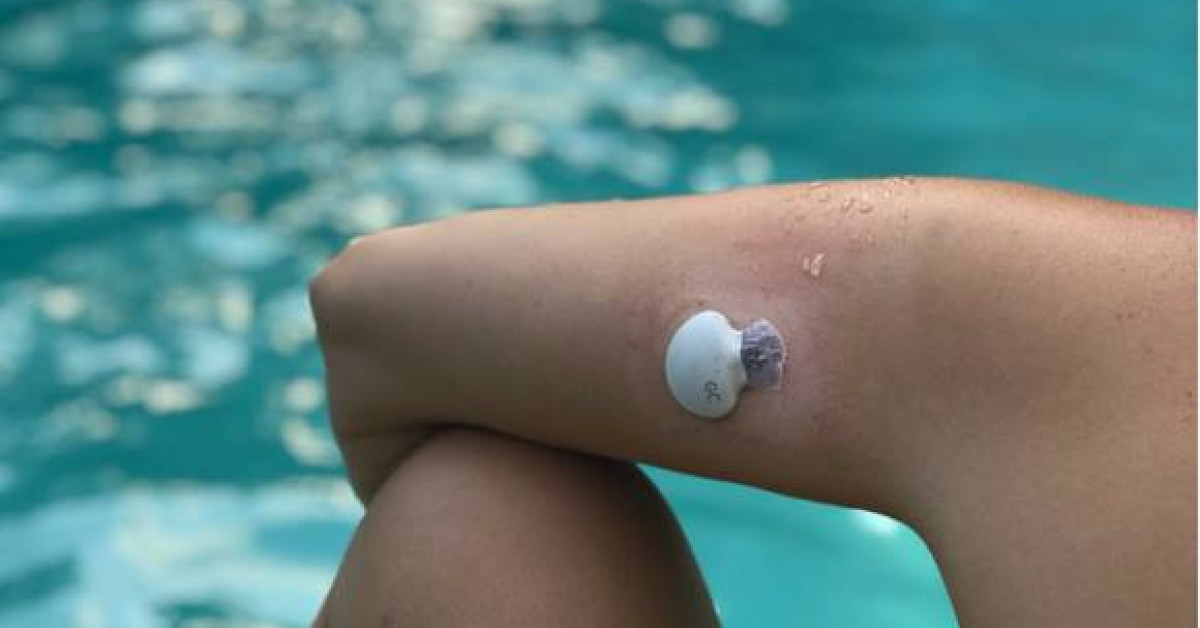 el brazo va adormecer la diabetes el brazo va adormecer la diabetes